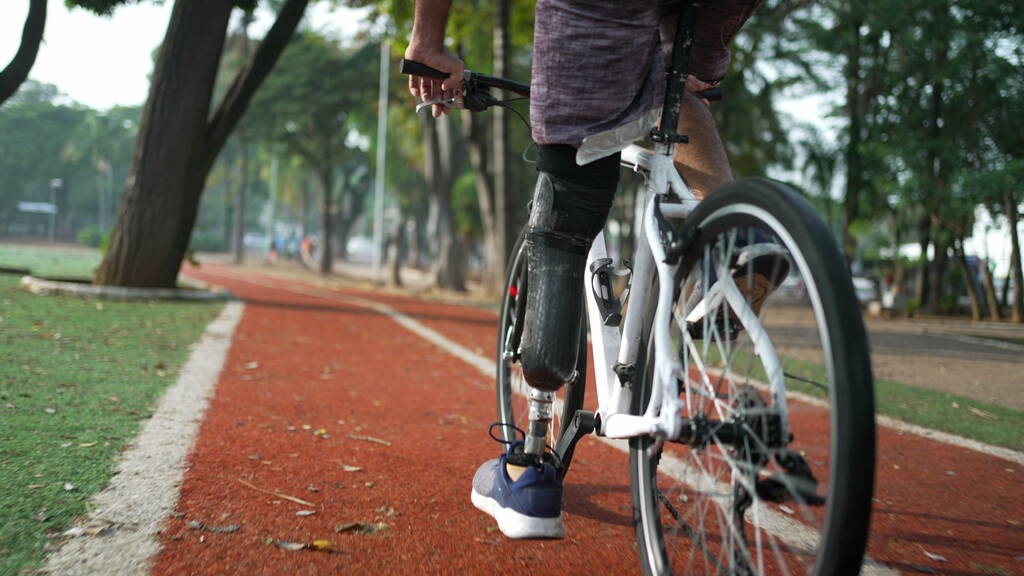 Disabled person riding bicycle using prosthetic leg